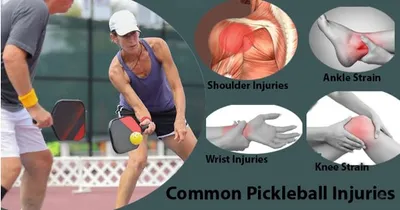 Pickleball Injuries.webp